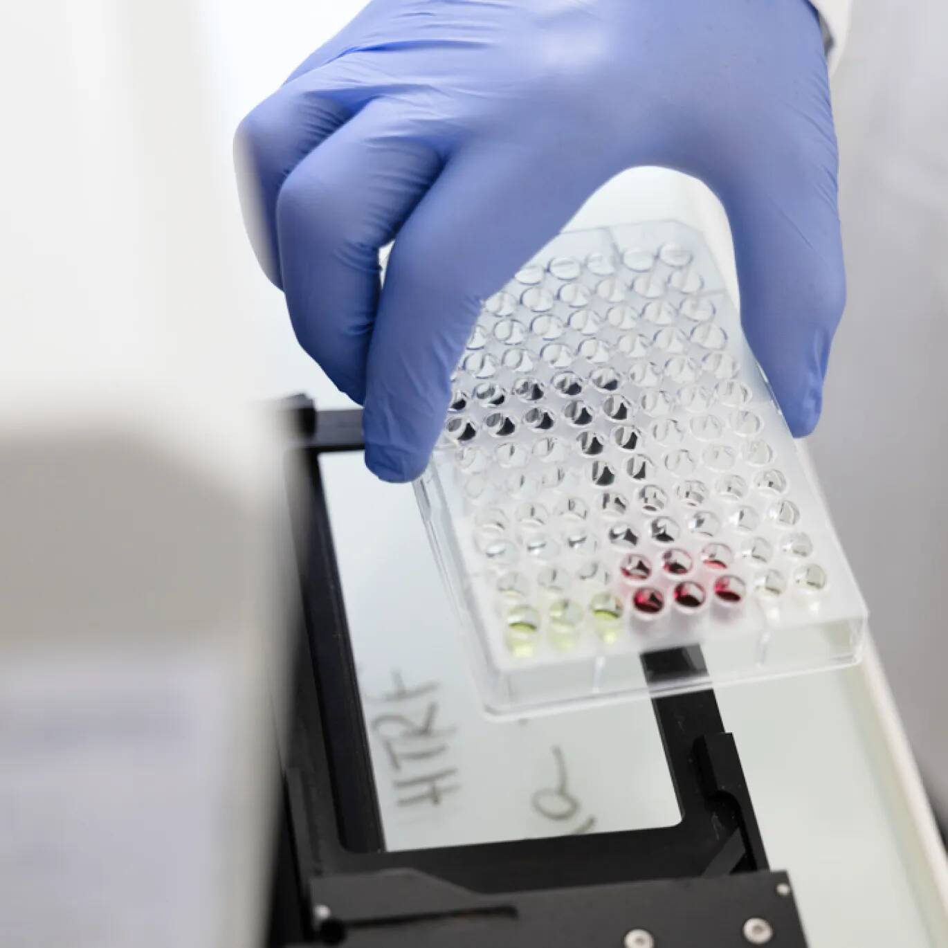 Les résultats de l’étude clinique REVERSE-IT publiés dans Nature Communications