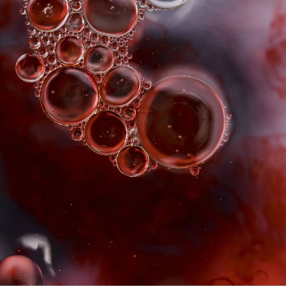 Hypercholestérolémie : quelles sont les complications possibles ?