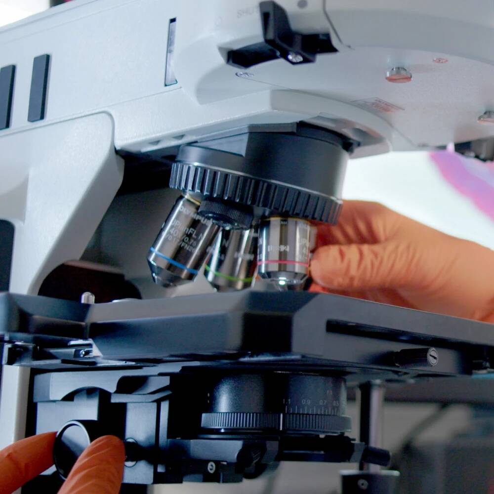 Perspectives pour le traitement des dyslipidémies