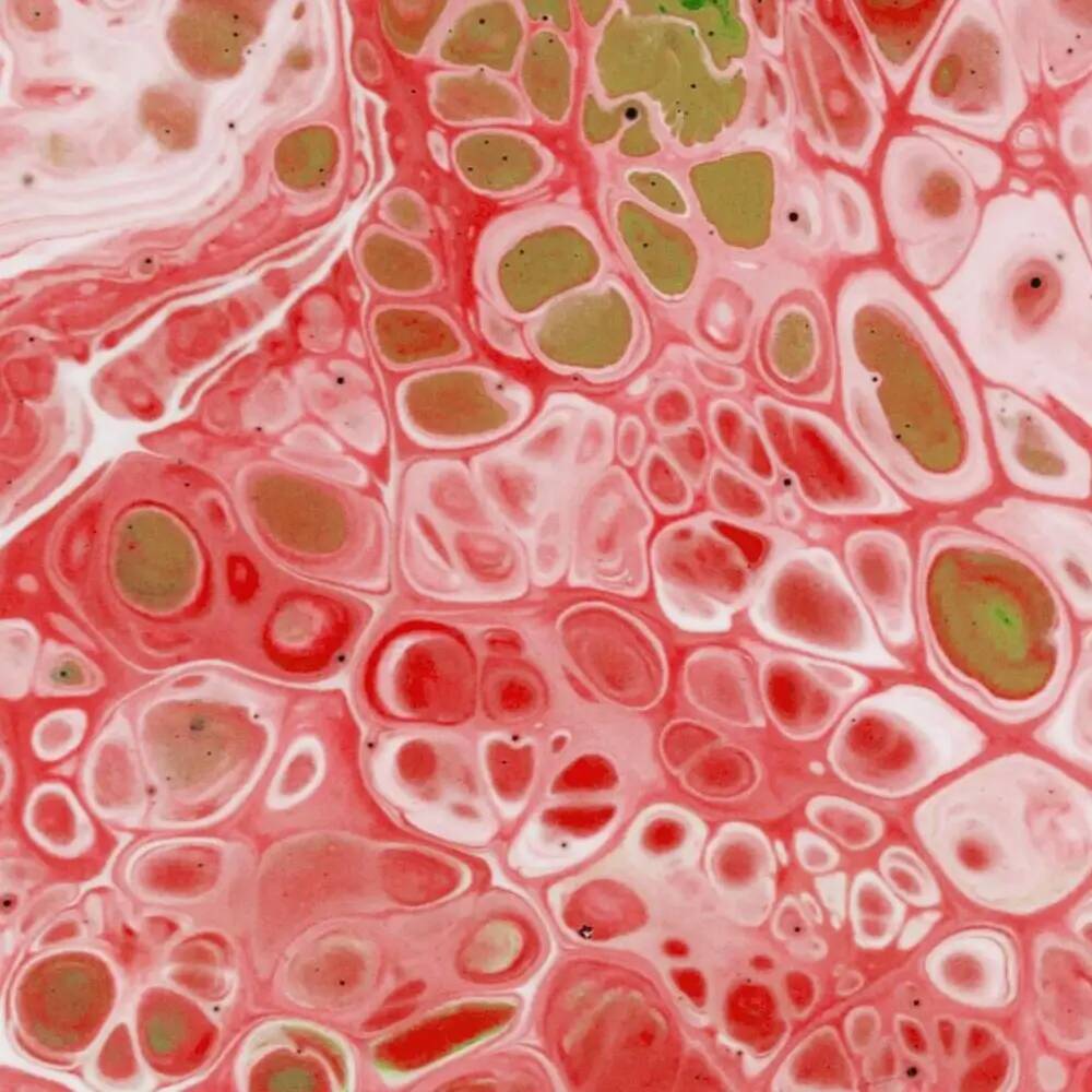 Cholestérol : comment le définir pour mieux le contrôler ?